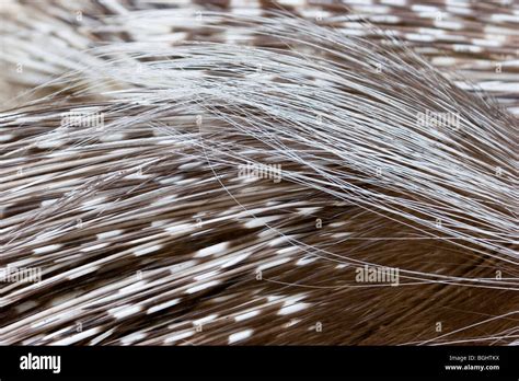 Porcupine Quills Stock Photo - Alamy