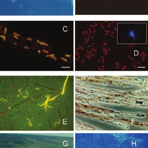 Examples of photoautotrophic marine diazotrophs. (A) Light microscope ...