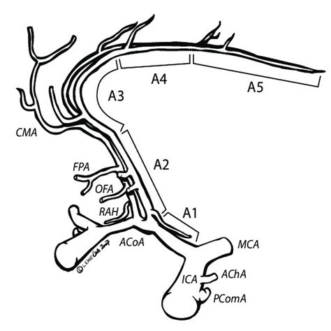 The segments (A1 to A5) and branches of the anterior cerebral artery ...