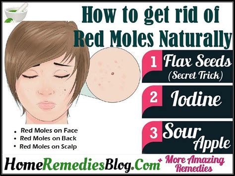 How to get rid of Red Moles Naturally | Red moles, How to get rid, Moles on face