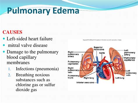 PPT - Chapter: 38 Pulmonary Circulation, Pulmonary Edema, Pleural Fluid PowerPoint Presentation ...