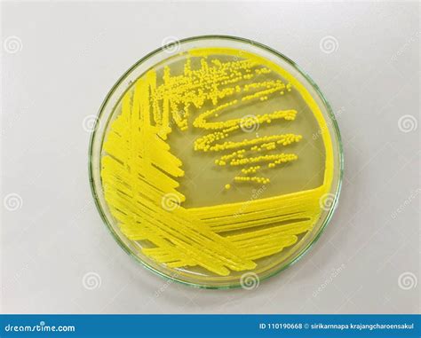 Micrococcus Luteus Royalty-Free Stock Photo | CartoonDealer.com #78001725