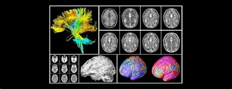 Meditation and Neuroplasticity: Five key articles | Meditation Research