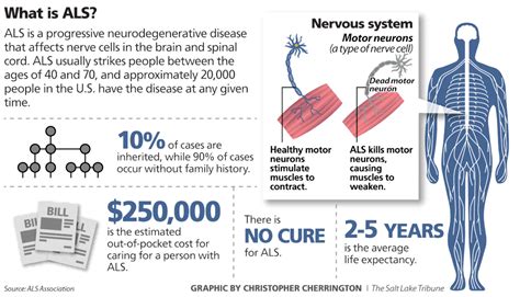 Amyotrophic Lateral Sclerosis: From Diagnosis to Treatment ...