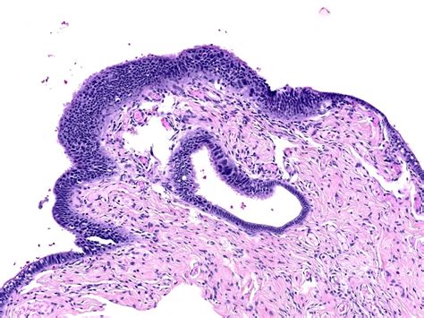 Fallopian Tube Histology