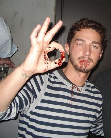 Shia LaBeouf pulls out his own tooth!