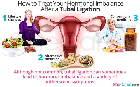 Tubal Ligation Side Effects Weight Gain | Blog Dandk