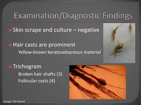 Sebaceous Adenitis