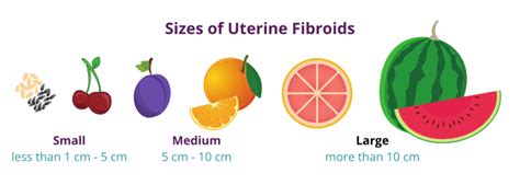 Fibroid Tumor Sizes: a Visual Guide | USA Fibroid Centers | Mex Alex