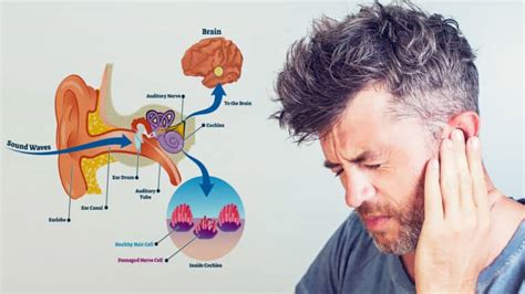 15 Causes of Ringing in the Ears (And How to Fix It)