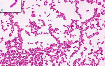 Escherichia coli O157:H7