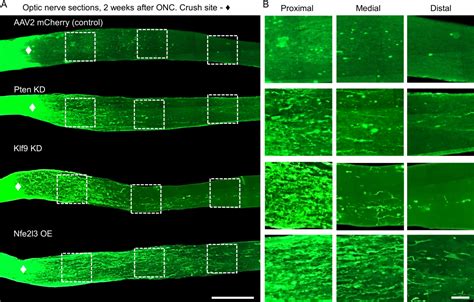 Optic Nerve Damage: A Path to Regeneration