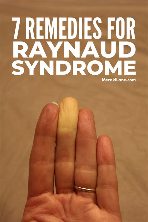 7 Natural Raynaud Syndrome Remedies