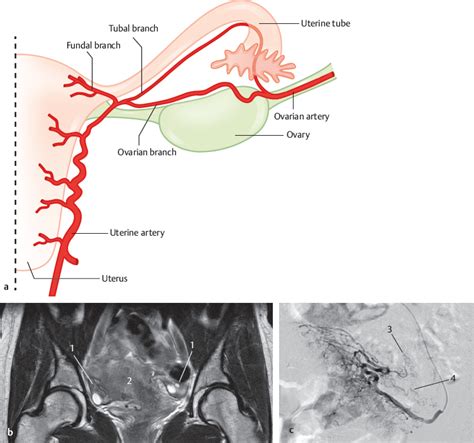 Ovarian Artery