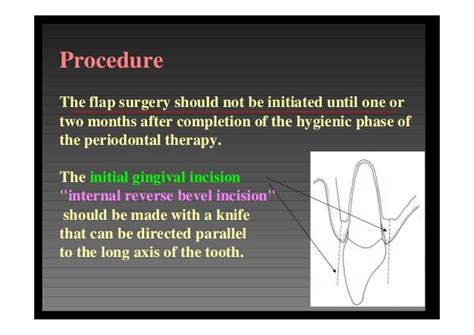 Modified widman flap