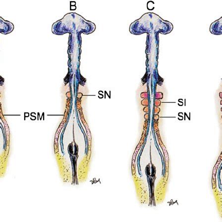 Platybasia in a 9-year-old child with no symptoms. The clivus – axis... | Download Scientific ...