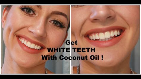 Does Brushing Your Teeth With Coconut Oil Whiten Them - Teeth Poster