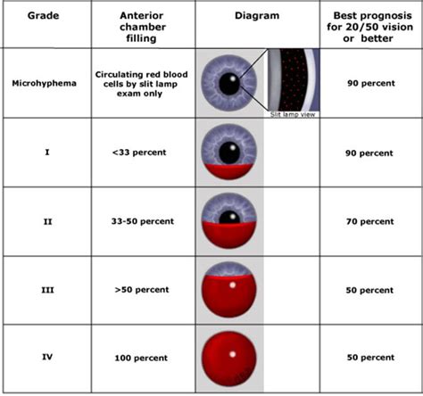 Traumatic Hyphema - What is it and how should it be treated? - County EM
