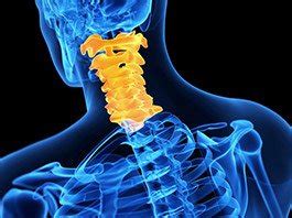 Cervical Myelopathy Causes and Treatments