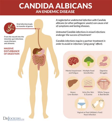 Candida Elim – Dr. Jockers Store