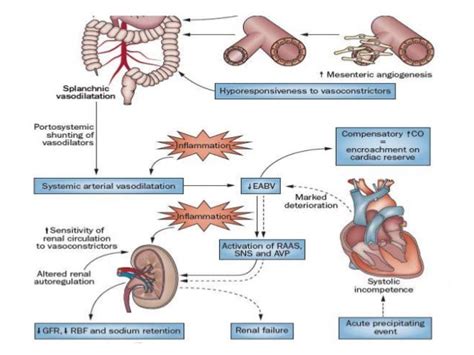 hepatorenal syndrome