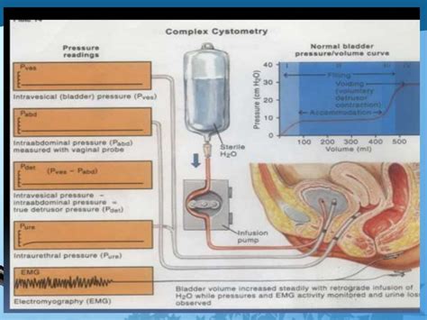 Urodynamic studies