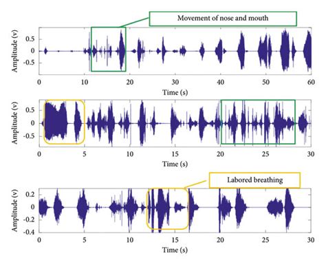 Three parts of abnormal sleep breathing sound data. | Download Scientific Diagram