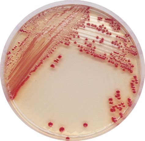 CHROMagar™ Acinetobacter - Chromagar