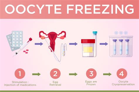 Egg Freezing Procedure in Gurgaon, Oocyte Freezing Treatment Delhi NCR