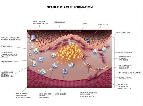 Low-Density Lipoprotein (LDL) in Atherosclerosis and Heart Disease