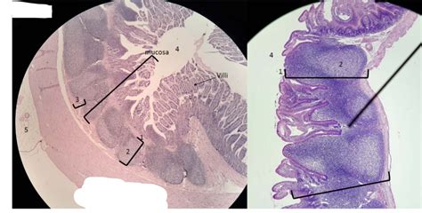 Ileum Diagram | Quizlet