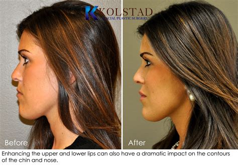 | Dr. Kolstad - San Diego Facial Plastic Surgeon