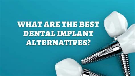 What Are the Best Alternatives to Dental Implants?