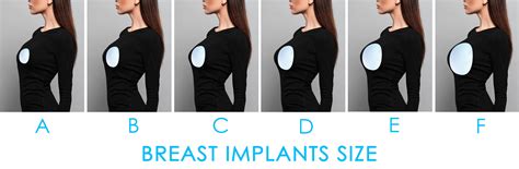 Types of Breast Implants