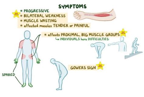 Myositis - Symptoms, Causes & Treatment - Santripty