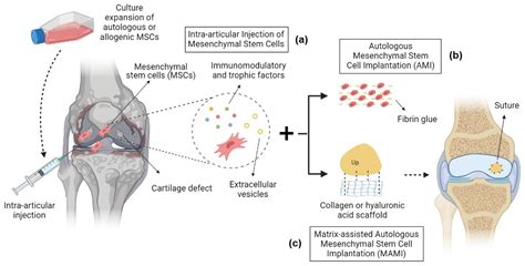 IJMS | Free Full-Text | Clinical Trials with Mesenchymal Stem Cell ...