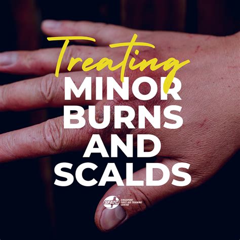 Minor Burns and Scalds Treatment