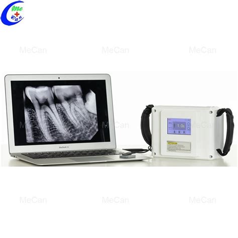 China Portable Dental X-Ray Machine Manufacturers Suppliers Factory - Made in China