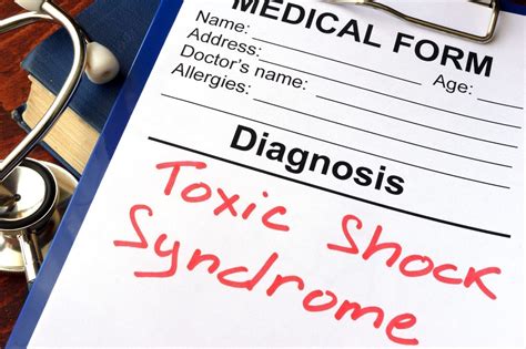 Toxic Shock Syndrome - Symptoms and Causes | familydoctor.org