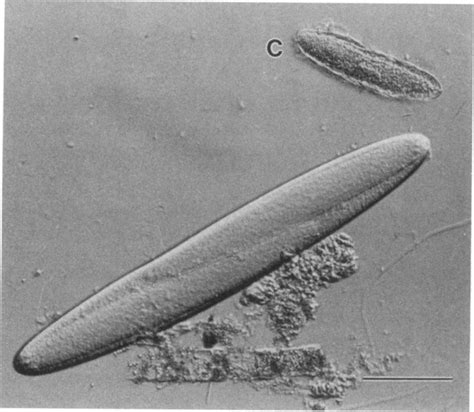 5 Largest Bacteria in the World - Largest.org