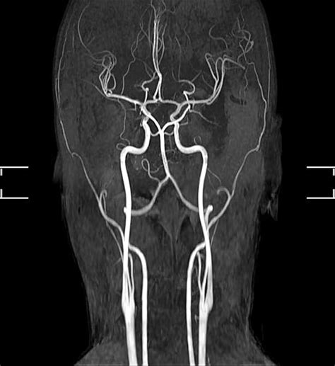 MRI/MRA | Southern California | Centrelake Imaging