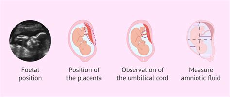 Fetal ultrasound in the third trimester of pregnancy