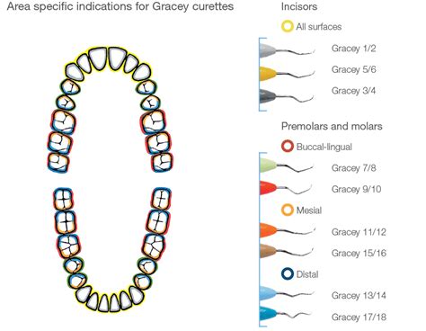 Periodontal instrument characteristics | LM-Dental