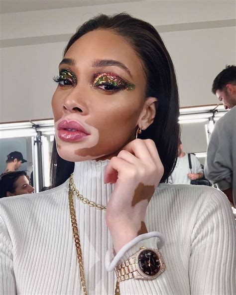 INBEAUT MAGAZINE on Instagram: “@winnieharlow” | Winnie harlow, Makeup ...