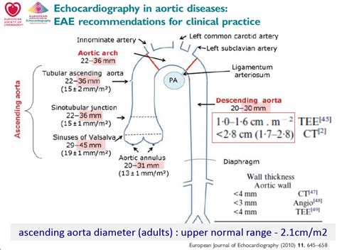 Aortic Education! - The Marfan Diary