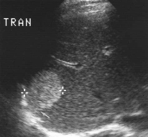 Abdomen Ultrasound | Ultrasound, Ultrasound sonography, Medical ultrasound