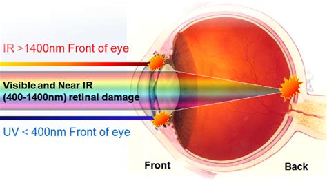 Irreversible Vision Damage - Don't Turn a Blind Eye to Laser Hazards ...