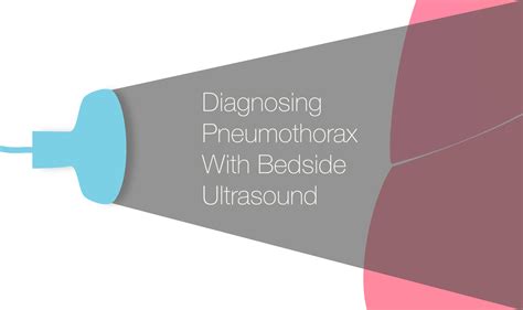 Diagnosing Pneumothorax With Bedside Ultrasound — NUEM Blog