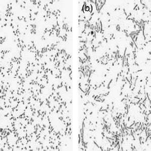 Light microscope (oil-immersion) of Bacteroides fragilis AUS-290 grown ...