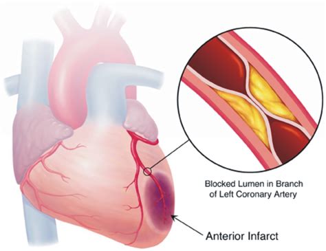 Family Health And Nutrition: HEART BEAT